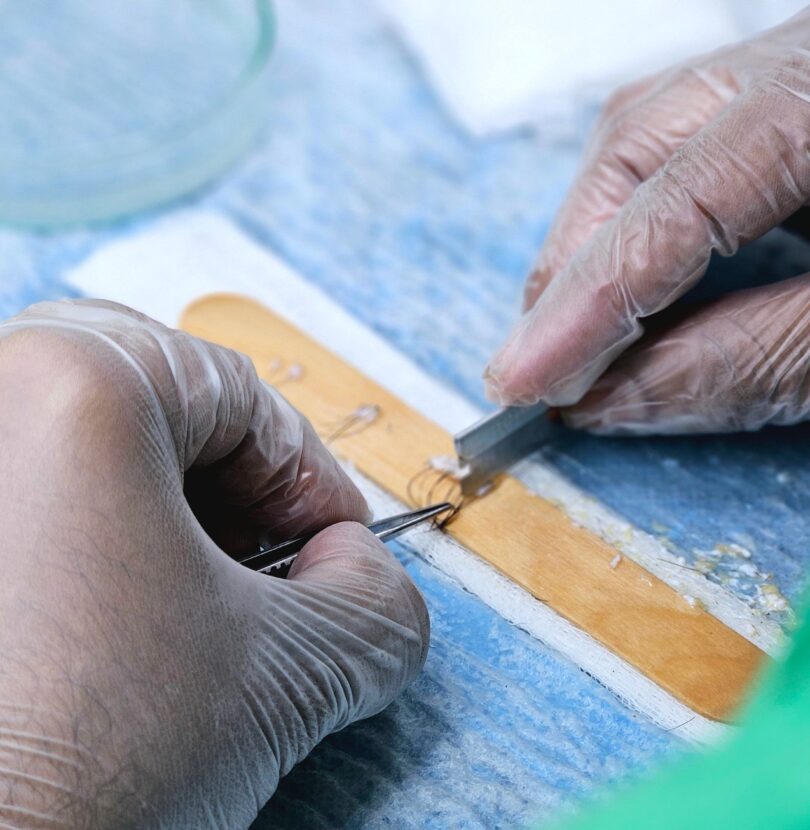 DHI Haartransplantation Ablauf: 7 Schritte vom ersten Gespräch bis zum vollen Haarwuchs