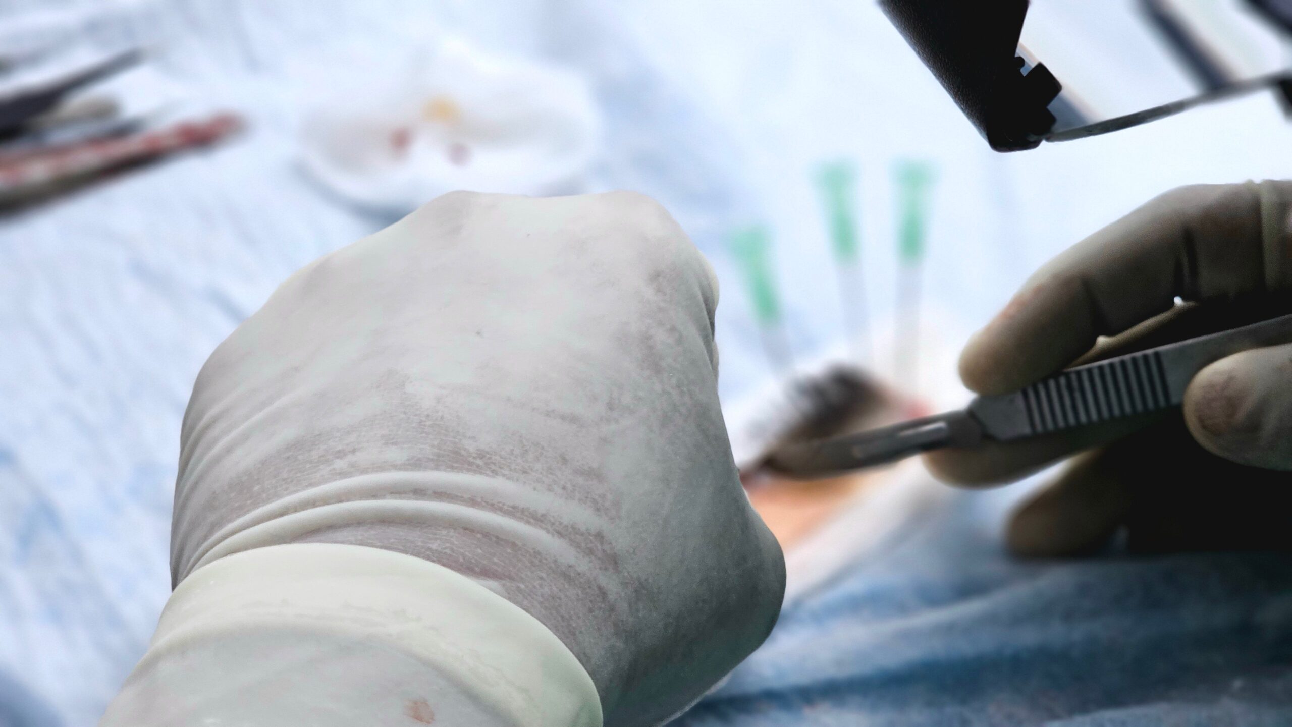 FUE Haartransplantation Methode erklärt